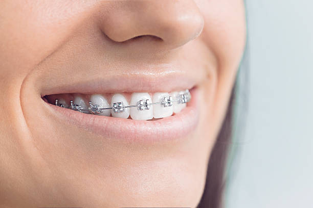 Best Root Canal Treatment  in Eureka Mill, SC